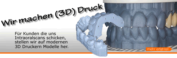 3D Druck